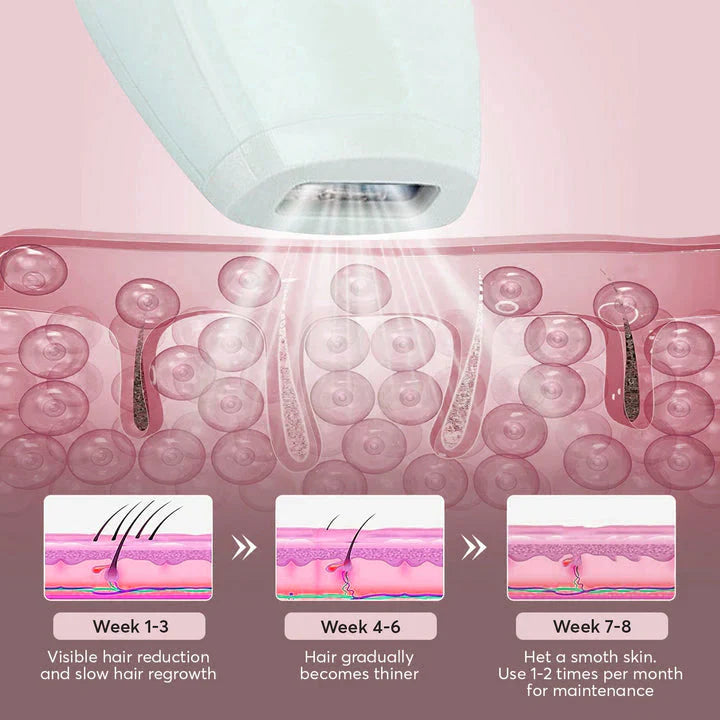 lovi Flash IPL Laser Hair Removal Device With 1 Million Flashes with Auto Features