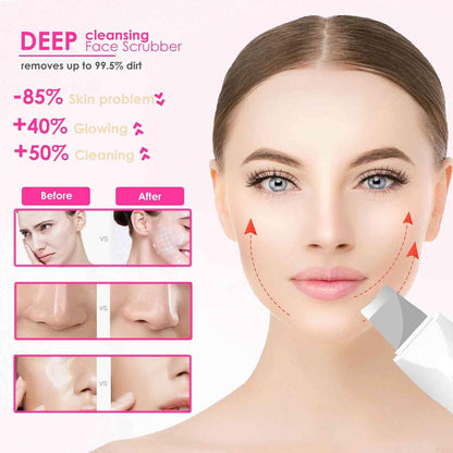 Rechargeable Face Scrubber & Skin Spatula