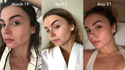 LED Face & Neck Anti-Aging Massager