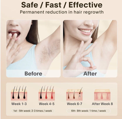 lovi Flash IPL Laser Hair Removal Device With 1 Million Flashes with Auto Features